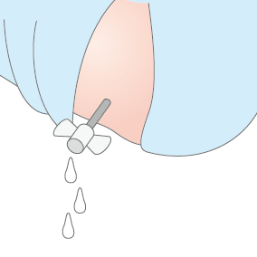 腦脊髓液排除測試のイメージ